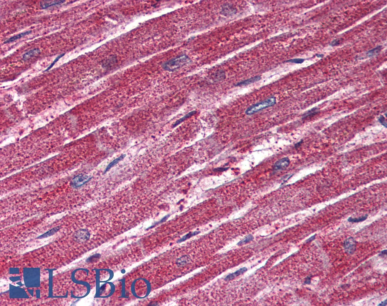 IHC-plus™ TRPM4 Antibody (N-Terminus)