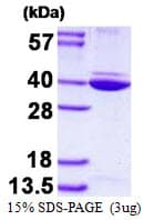 Human ANXA8L1 Protein (Recombinant His)