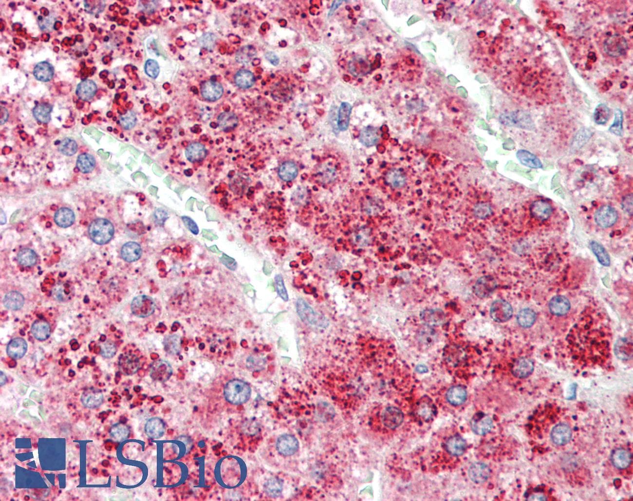 IHC-plus™ APOD / Apolipoprotein D Antibody (aa70-80)