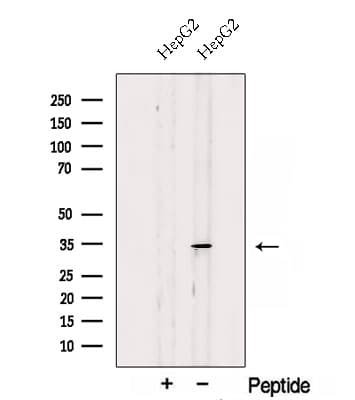 SDHB Antibody