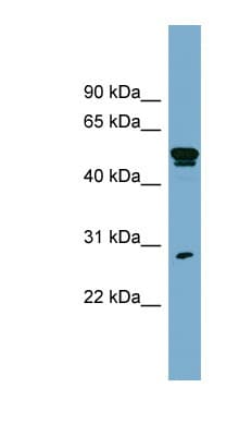 SLA Antibody (C-Terminus)