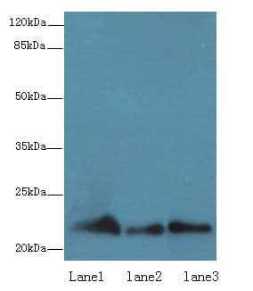 Polyclonal Rabbit anti-Human RAP1B Antibody (IHC, WB)