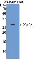 TNNI3 / Cardiac Troponin I Antibody (aa1-203)