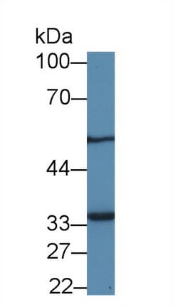 MTX1 / Metaxin 1 Antibody (APC)