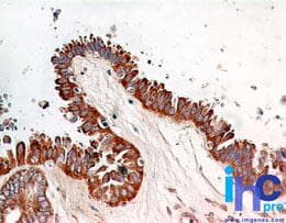 RELA / NFKB p65 Antibody (aa526-539, clone 112A1021, Azide-free)