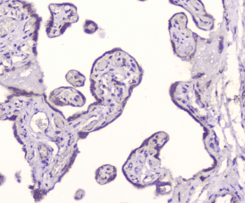 Polyclonal Rabbit anti-Human GOLGA2 / GM130 Antibody (IHC, WB)