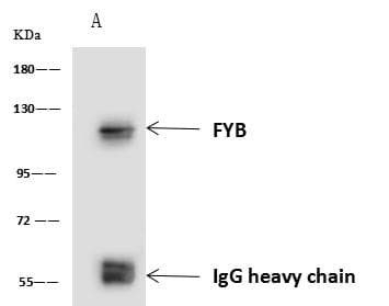 ADAP / FYB Antibody