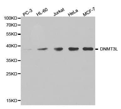 DNMT3L Antibody