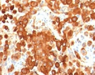 PMEL / SILV / gp100 Antibody (clone MSSG95)