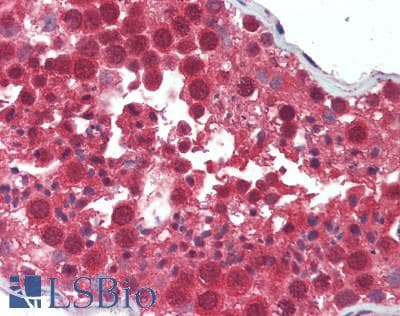 IHC-plus™ UBE1L2 / UBE1L2 Antibody (aa1002-1052)