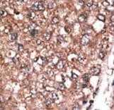 Polyclonal Rabbit anti-Human DHAND / HAND2 Antibody (aa179-207, IHC, WB)