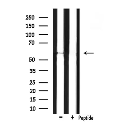 CHRM5 / M5 Antibody
