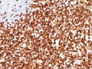 CD45RO Antibody (clone CDLA45RO-1)