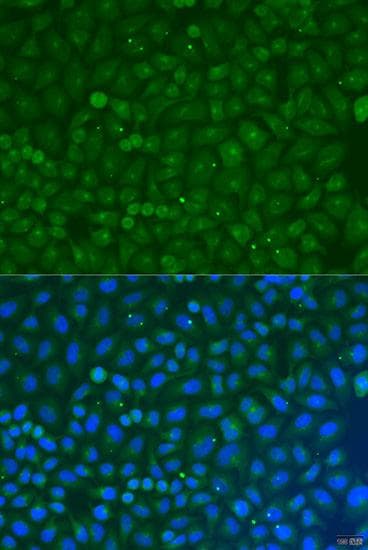 COG4 Antibody