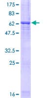 Human LRG1 / LRG Protein (Recombinant GST)