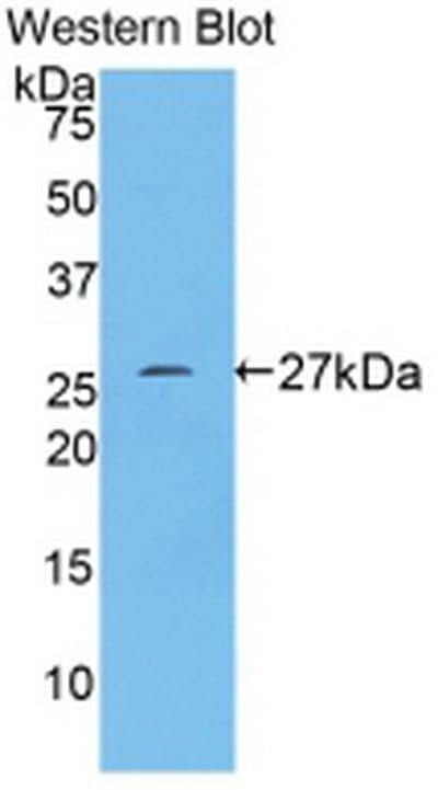 CD71 / Transferrin Receptor Antibody
