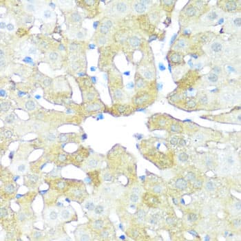 Polyclonal Rabbit anti-Human NAMPT / Visfatin Antibody (IHC, IF, WB)
