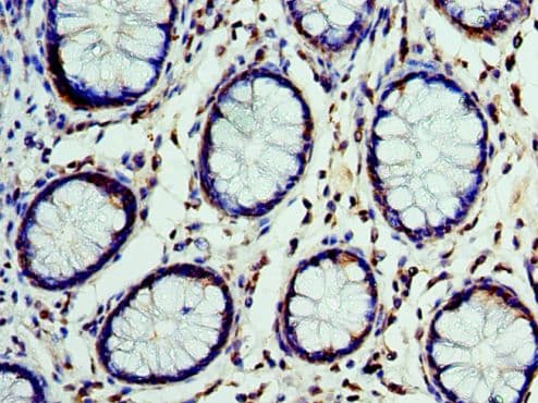 Polyclonal Rabbit anti-Human CST7 / Cystatin F Antibody (aa20-145, IHC)