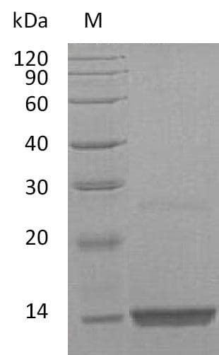 Human FGF9 Protein (Recombinant)