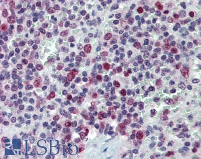 IHC-plus™ TOP1 / Topoisomerase I Antibody (aa100-150)