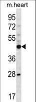 PHKG2 Antibody (aa2-29)