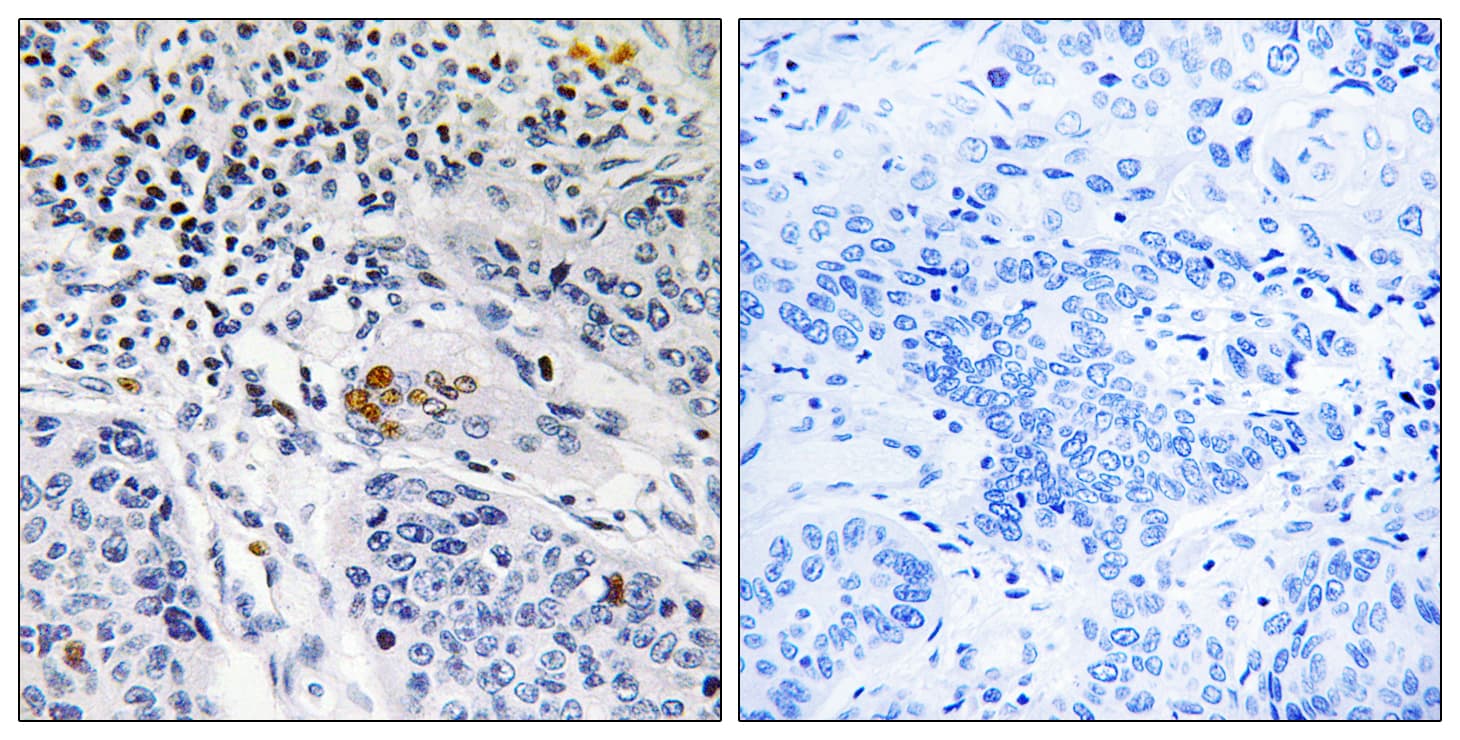 Polyclonal Rabbit anti-Human ZBTB40 Antibody (aa1121-1170, IHC)
