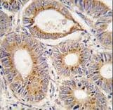 Polyclonal Rabbit anti-Human FGF1 / Acidic FGF Antibody (aa5-30, IHC, IF, WB)