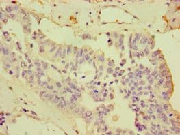 CDCP1 Antibody (aa523-836)