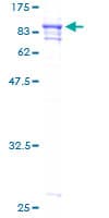 Human PRCC / RCCP1 Protein (Recombinant GST)