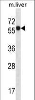 SLC45A3 / Prostein / p501S Antibody (aa290-319)