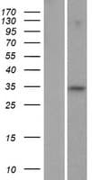 FAM110C Protein (Over-Expression Lysate Myc-DDK (Flag))