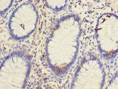 Polyclonal Rabbit anti-Human TSPAN1 / TM4SF Antibody (IHC)
