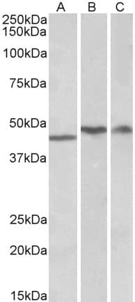 PathPlus™ TDP-43 / TARDBP Antibody (aa140-153)