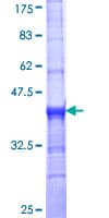 Human SLC18A2 / VMAT2 Protein (Recombinant GST, N-terminus)