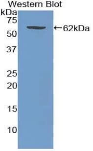 WNT5A Antibody (aa62-381)
