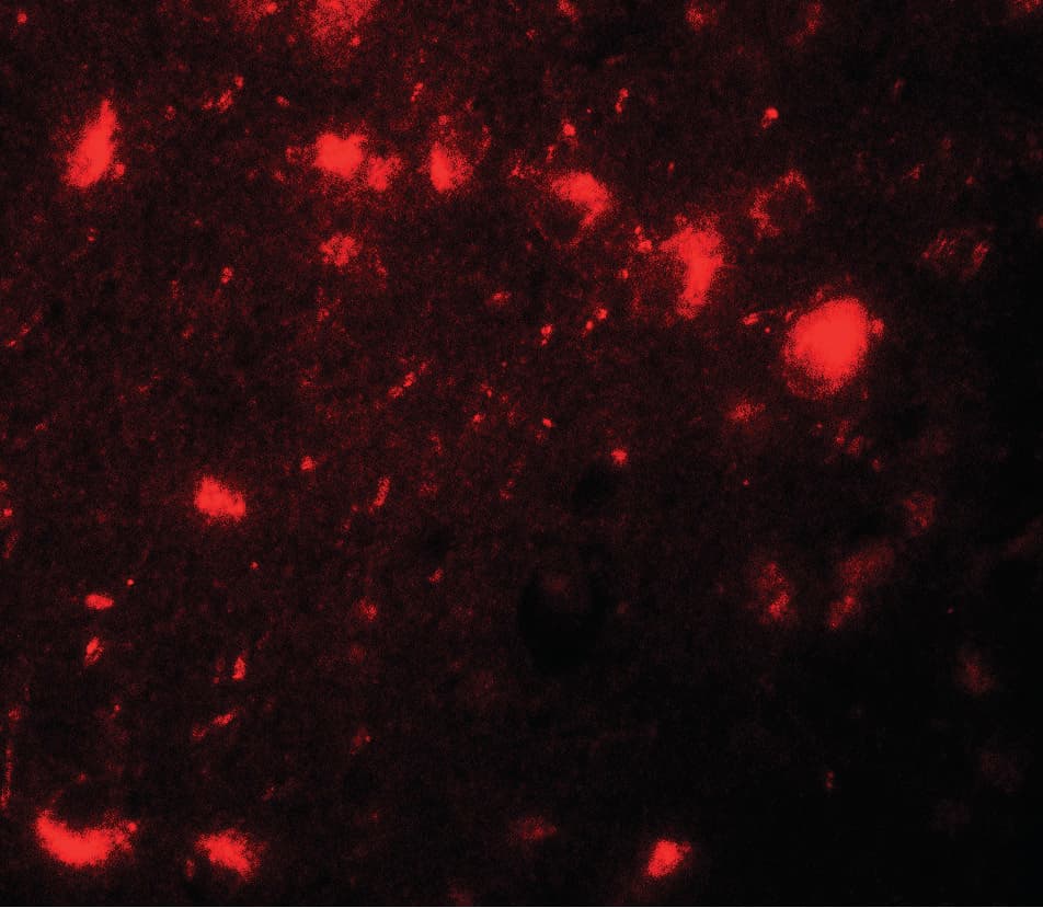 CBX4 Antibody