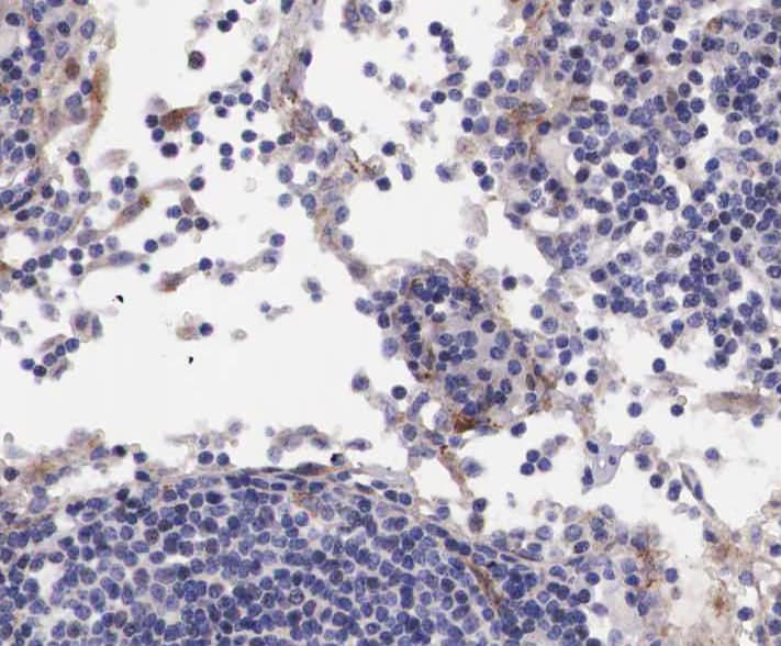BLNK Antibody (phospho-Tyr96)
