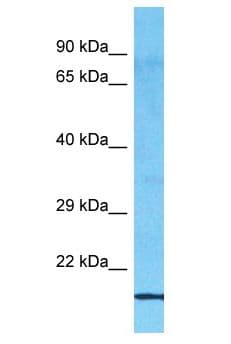 Polyclonal Rabbit anti-Human MED30 Antibody (aa104-153, WB)