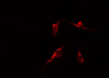 Polyclonal Rabbit anti-Human MBTPS1 / S1P Antibody (IHC, IF, WB)