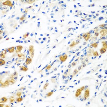 GHBP / BLVRB Antibody