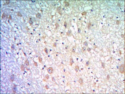 KLHL21 Antibody (clone 2H4)