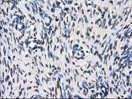 KIAA0153 / TTLL12 Antibody (clone OTI7F11)