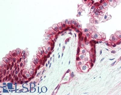UTRN / Utrophin Antibody (aa1-252)