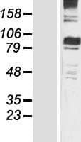 MTHFR Protein (Over-Expression Lysate Myc-DDK (Flag))