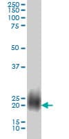 NBL1 / DAN Antibody (clone 2G4)