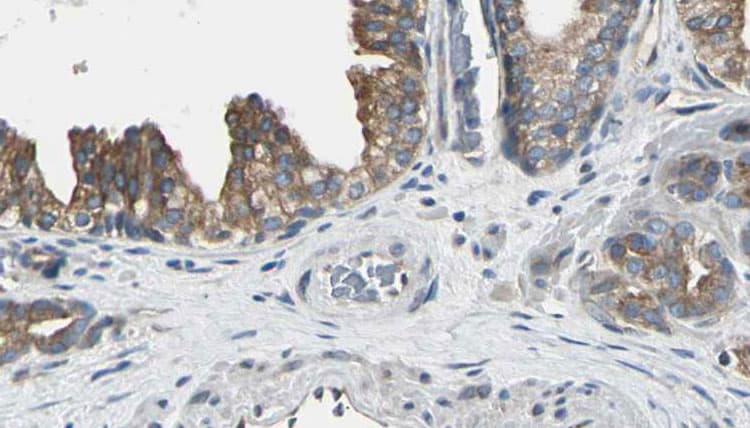 AK8 Antibody