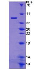 Human FN3K / Fructosamine-3-Kinase Protein (Recombinant His, N-Terminal)