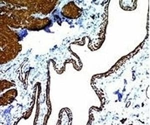 ACTA2 / Smooth Muscle Actin Antibody (clone ACTA2/791, Ready-to-Use)