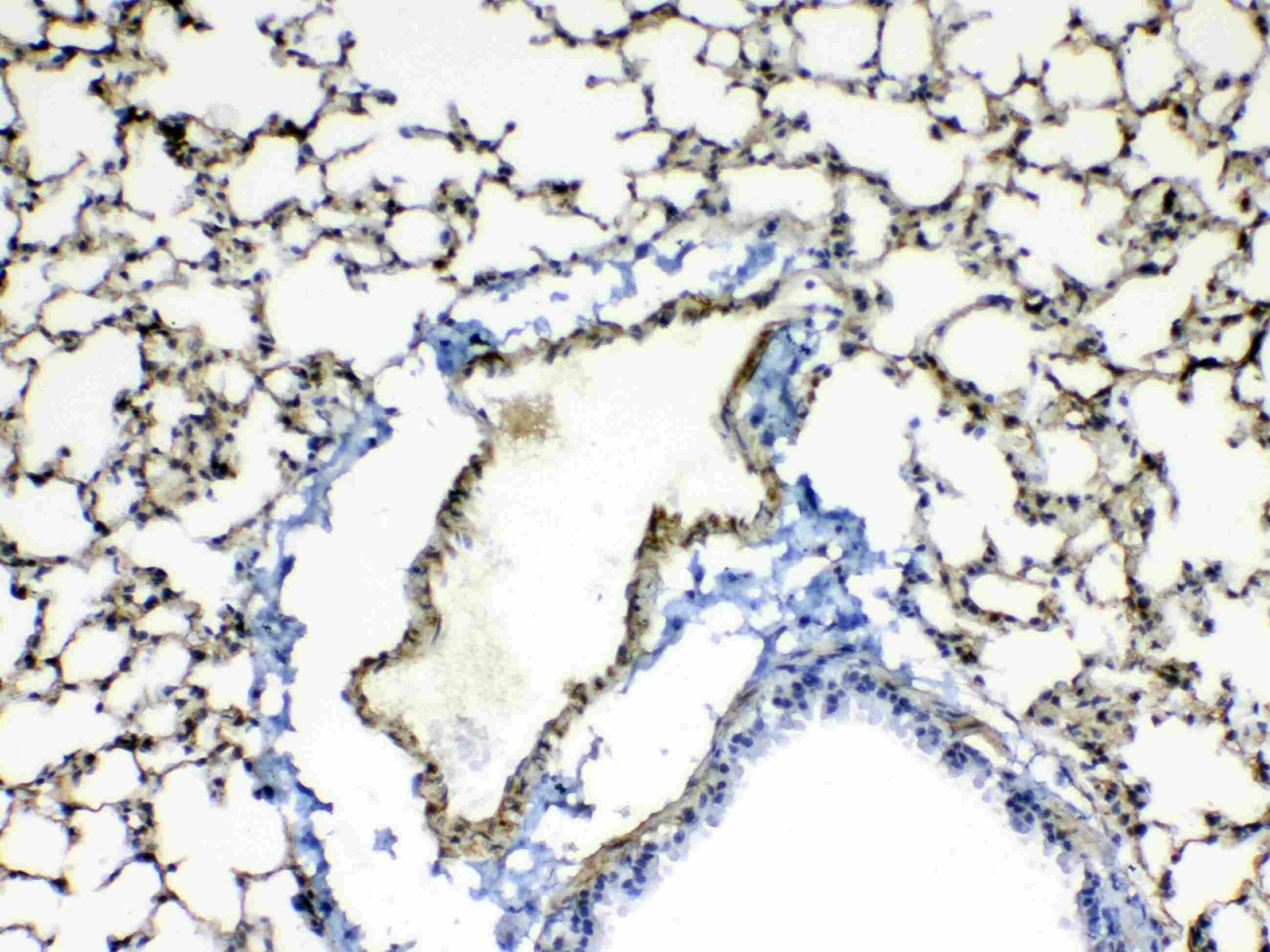Polyclonal Rabbit anti-Rat POSTN / Periostin Antibody (IHC, WB)