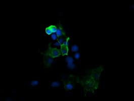 MAP2K1 / MKK1 / MEK1 Antibody (clone OTI2A9)
